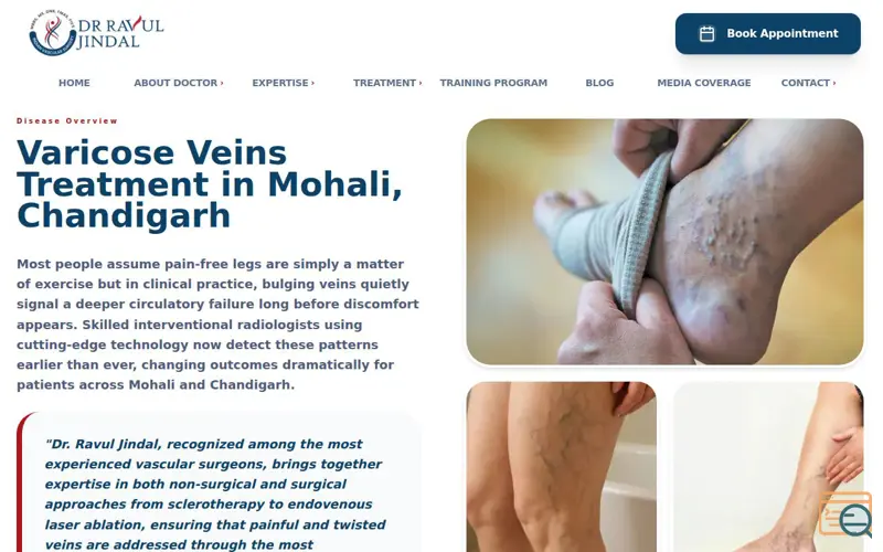 Screenshot of Varicose Veins Treatment In Mohali