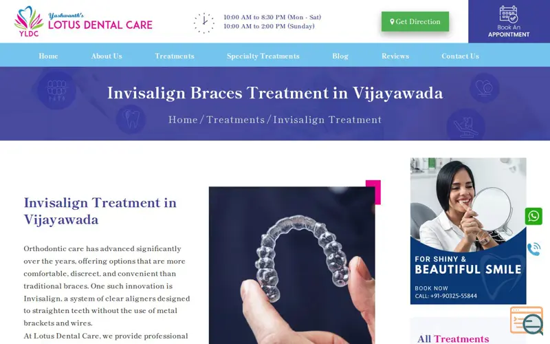 Screenshot of Invisible Braces Treatment in Vijayawada