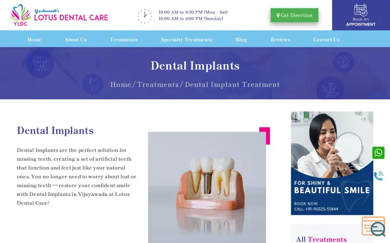 Screenshot of Dental Implants in Vijayawada