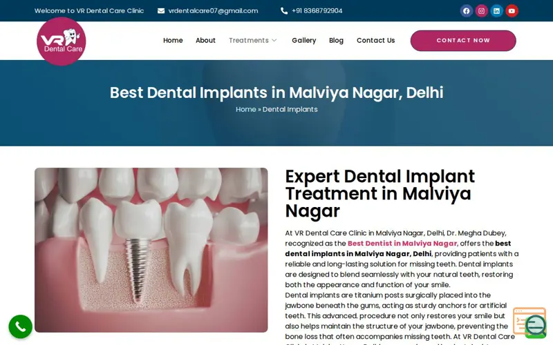 Screenshot of Best Dental Implant Clinic Malviya Nagar